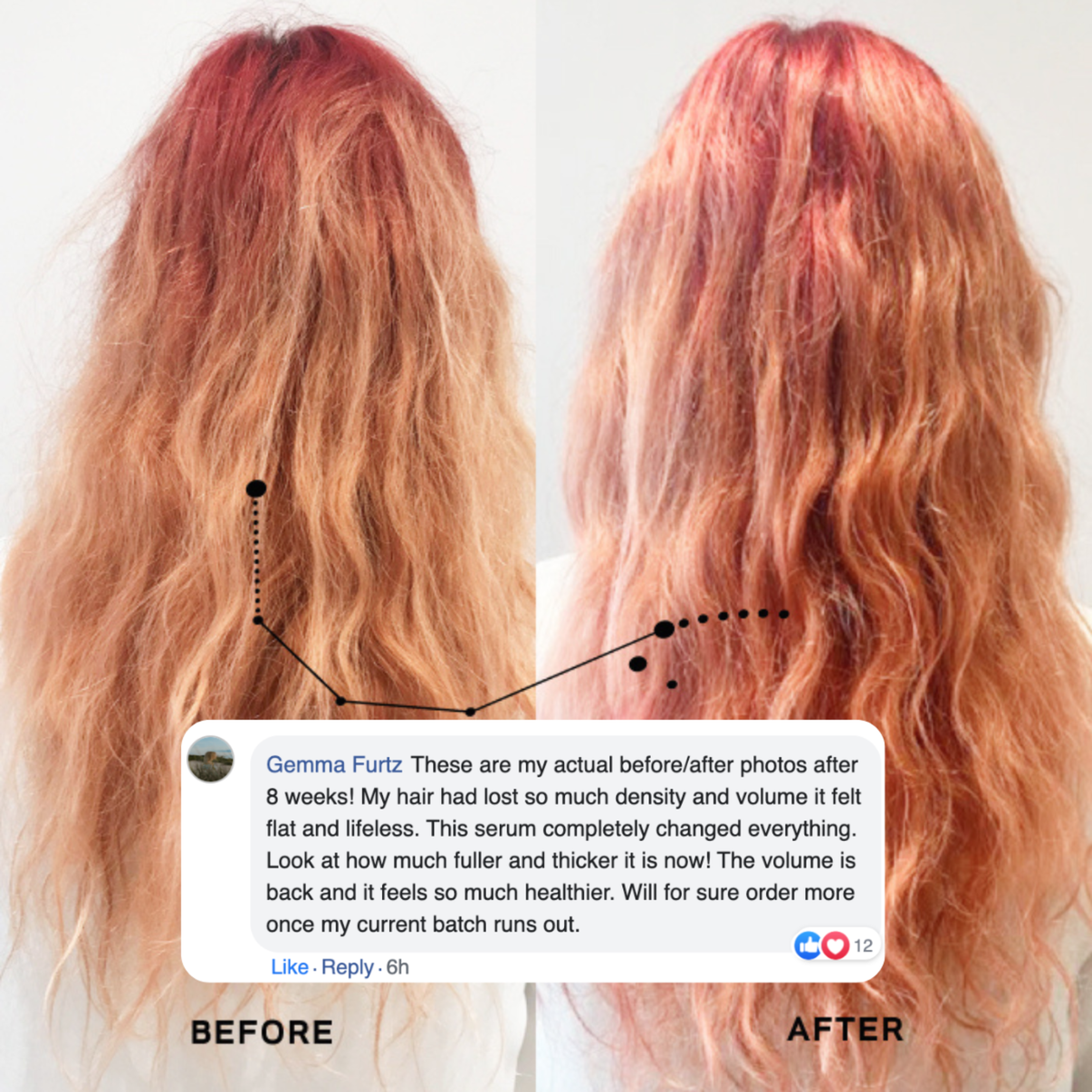 Batana Hair Oil + Serum [Buy 1 Get 1 Free]